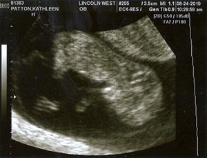 20100828-scan0001_2[2]