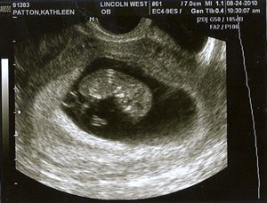 20100828-scan0002_2[2]