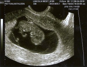 20100828-scan0003_2[2]