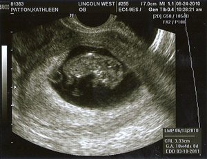 20100828-scan0004_2[2]