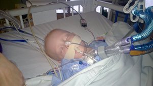 Nathan after surgery